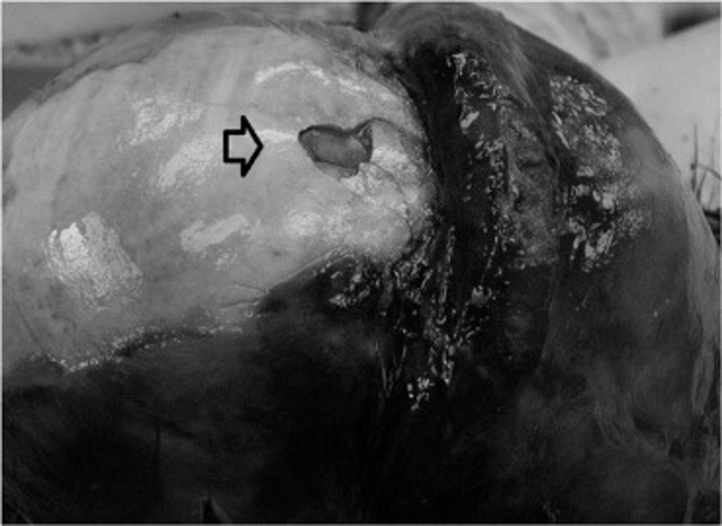 TZ: Osm z deseti usmrcených cyklistů nemělo přilbu! 03
